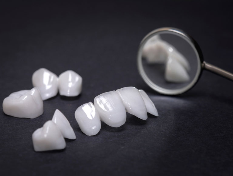 Dental Bridges in King of Prussia, PA