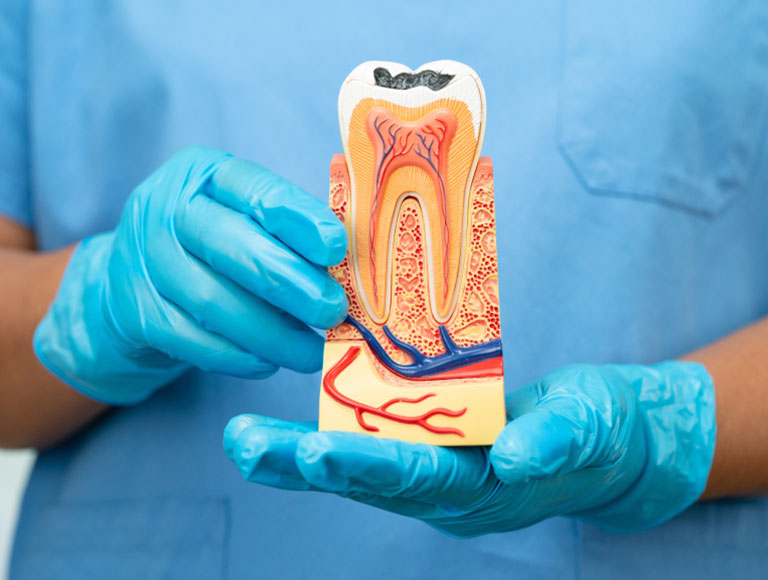 Root Canal Treatment in King of Prussia, PA